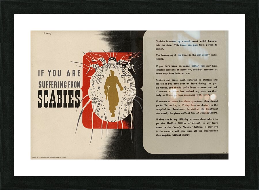 If You are Suffering from Scabies Picture Frame print
